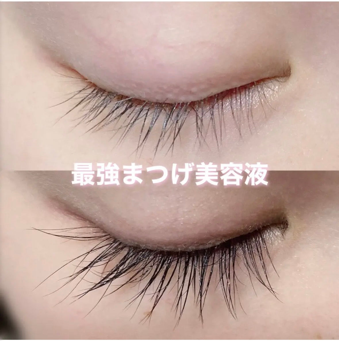 EMAKED Eyelash Serum from Japan – Lash Growth Support, Fuller & Longer-Looking Eyelashes